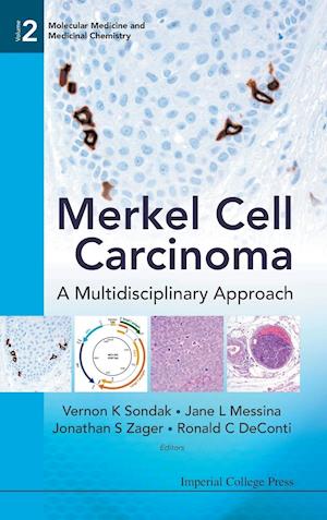 Merkel Cell Carcinoma: A Multidisciplinary Approach