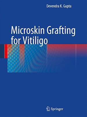 Microskin Grafting for Vitiligo