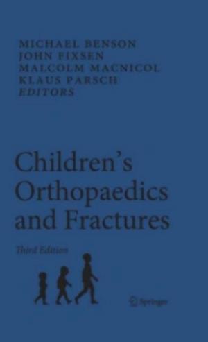 Children's Orthopaedics and Fractures