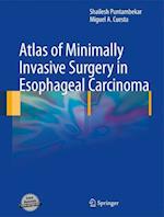 Atlas of Minimally Invasive Surgery in Esophageal Carcinoma