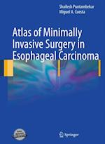 Atlas of Minimally Invasive Surgery in Esophageal Carcinoma