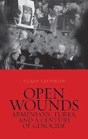 Open Wounds