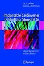 Implantable Cardioverter Defibrillator Stored ECGs