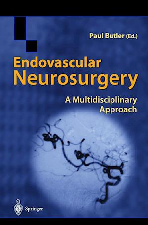 Endovascular Neurosurgery