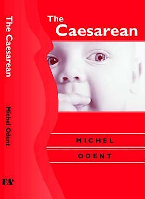 The Caesarean