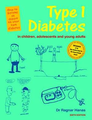 6th Ed Type 1 Diabetes in Children, Adolescents and Young Adults - 6th Edn