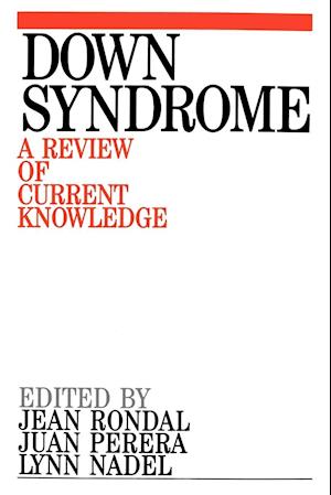 Down Syndrome – A Review of Current Knowledge