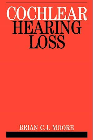 Cochlear Hearing Loss