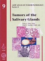 Tumors of the Salivary Glands