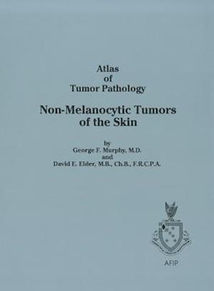 Non-Melanocytic Tumors of the Skin