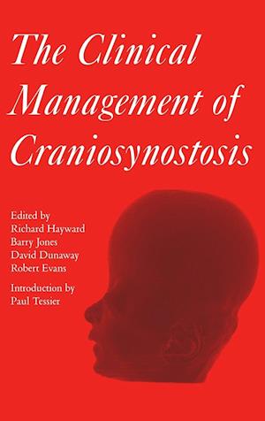 The Clinical Management of Craniosynostosis