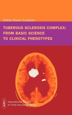 Tuberous Sclerosis Complex