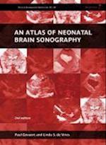 An Atlas of Neonatal Brain Sonography – Clinics in Developmental Medicine
