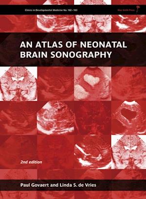 Atlas of Neonatal Brain Sonography, 2nd Edition