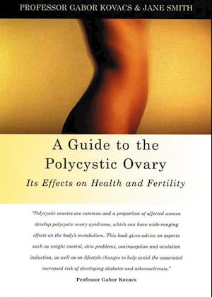 Kovacs, G: Guide to the Polycystic Ovary