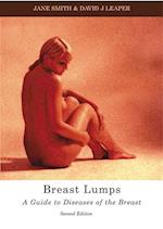 Smith, J: Breast Lumps