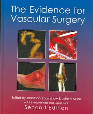 The Evidence for Vascular Surgery; second edition
