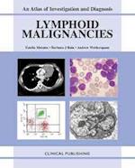 Lymphoid Malignancies