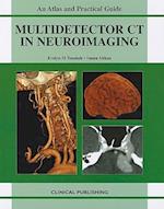 Multidetector CT in Neuroimaging