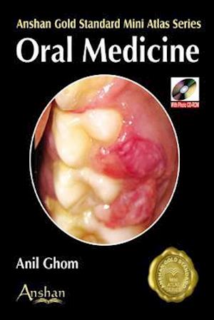 Oral Medicine [With CDROM]