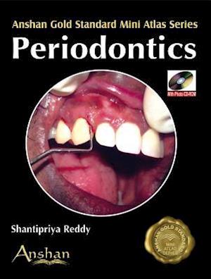 Mini Atlas of Periodontics [With CDROM]