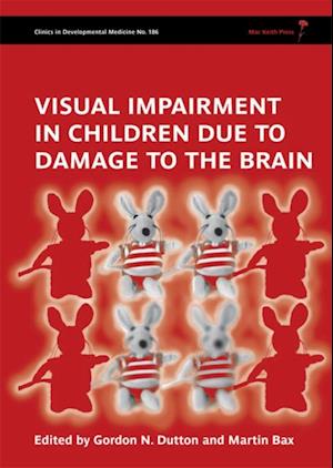 Visual Impairment in Children due to Damage to the Brain