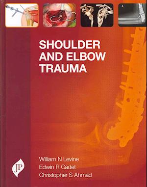 Shoulder and Elbow Trauma