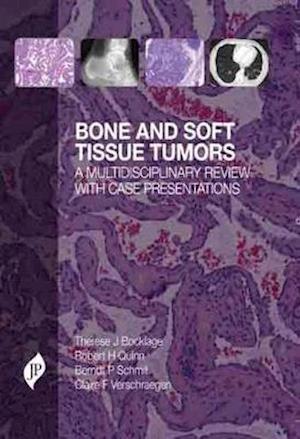 Bone and Soft Tissue Tumors