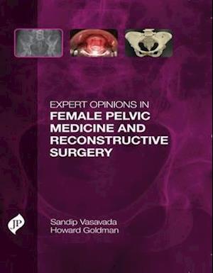 Expert Opinions in Female Pelvic Medicine and Reconstructive Surgery