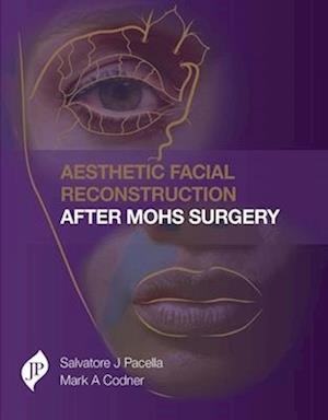 Aesthetic Facial Reconstruction After Mohs Surgery