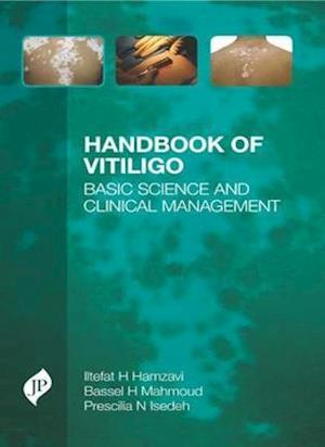 Handbook of Vitiligo