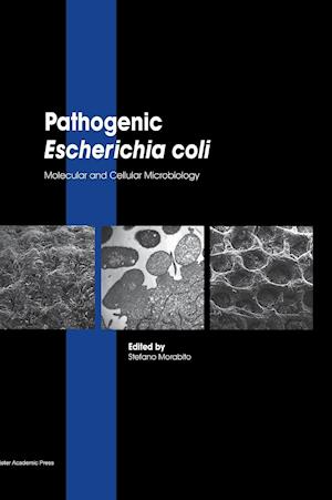 Pathogenic Escherichia Coli