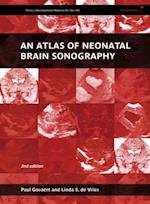 Atlas of Neonatal Brain Sonography, 2nd Edition