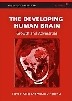 The Developing Human Brain – Growth and Adversities