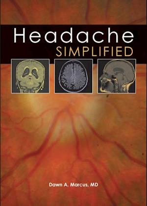 Headache Simplified