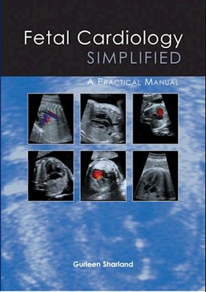 Fetal Cardiology Simplified