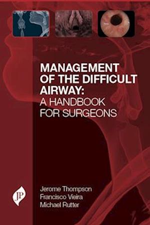 Management of the Difficult Airway: A Handbook for Surgeons