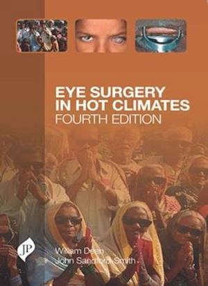 Eye Surgery in Hot Climates