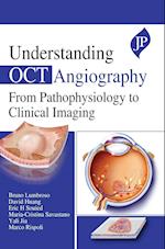 Understanding OCT Angiography