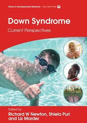 Down Syndrome – Current Perspectives