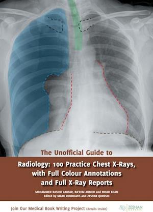 Unofficial Guide to Radiology