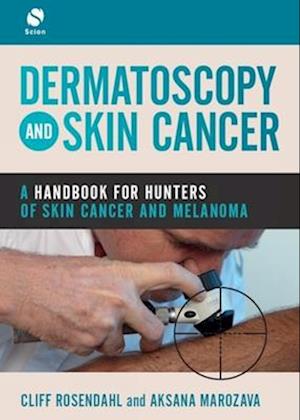 Dermatoscopy and Skin Cancer