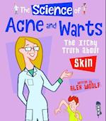 The Science of Acne & Warts