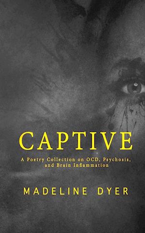 Captive