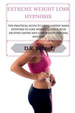 Extreme Weight Loss Hypnosis: The practical guide to using gastric band hypnosis to lose weight quickly. Stop exciting eating and lose weight natural 