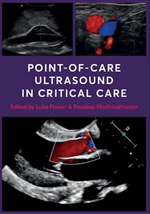 Point-of-Care Ultrasound in Critical Care