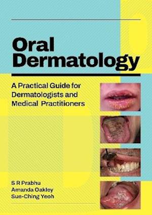 Oral Dermatology