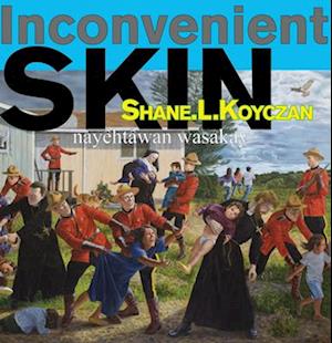 Inconvenient Skin / Nayêhtâwan Wasakay