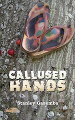 Callused Hands