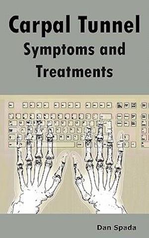 Carpal Tunnel Symptoms and Treatments: All about Carpal Tunnel Syndrome Causes, Diagnosing, Symptoms, Signs, Non-Surgical and Surgical Treatments, Alt